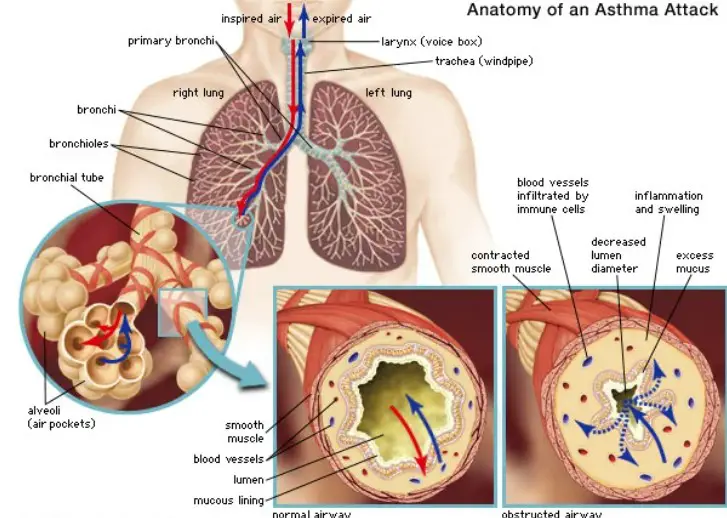 Anatomy and Pathophysiology of Asthma